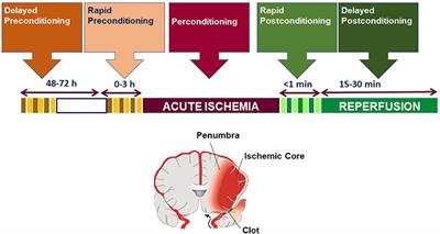 Emerging Role of microRNAs in Stroke Protection Elicited by Remote Postconditioning